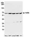 YARS / Tyrosyl-tRNA Synthetase Antibody - Detection of human and mouse YARS by western blot. Samples: Whole cell lysate (50 µg) from HeLa, HEK293T, Jurkat, mouse TCMK-1, and mouse NIH 3T3 cells prepared using NETN lysis buffer. Antibody: Affinity purified rabbit anti-YARS antibody used for WB at 0.1 µg/ml. Detection: Chemiluminescence with an exposure time of 30 seconds.