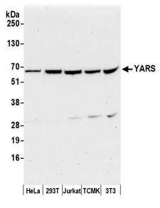 YARS / Tyrosyl-tRNA Synthetase Antibody - Detection of human and mouse YARS by western blot. Samples: Whole cell lysate (50 µg) from HeLa, HEK293T, Jurkat, mouse TCMK-1, and mouse NIH 3T3 cells prepared using NETN lysis buffer. Antibody: Affinity purified rabbit anti-YARS antibody used for WB at 0.1 µg/ml. Detection: Chemiluminescence with an exposure time of 30 seconds.