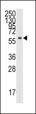 YARS / Tyrosyl-tRNA Synthetase Antibody - Western blot of anti-YARS Antibody in CEM cell line lysates (35 ug/lane). YARS(arrow) was detected using the purified antibody.