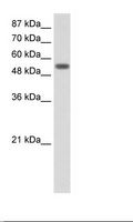 YARS / Tyrosyl-tRNA Synthetase Antibody - Jurkat Cell Lysate.  This image was taken for the unconjugated form of this product. Other forms have not been tested.