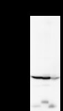YARS / Tyrosyl-tRNA Synthetase Antibody - Detection of YARS by Western blot. Samples: Whole cell lysate from human HeLa (H, 50 ug) , mouse NIH3T3 (M, 50 ug) and rat F2408 (R, 50 ug) cells. Predicted molecular weight: 59 kDa