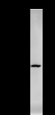 YARS / Tyrosyl-tRNA Synthetase Antibody - Immunoprecipitation: RIPA lysate of HeLa cells was incubated with anti-YARS mAb. Predicted molecular weight: 59 kDa