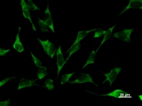 YARS / Tyrosyl-tRNA Synthetase Antibody - Immunostaining analysis in HeLa cells. HeLa cells were fixed with 4% paraformaldehyde and permeabilized with 0.1% Triton X-100 in PBS. The cells were immunostained with anti-YARS mAb.