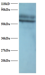 YARS / Tyrosyl-tRNA Synthetase Antibody - Western blot of Tyrosyl-tRNA synthetase, cytoplasmic Antibody at 2 ug/ml + 293T whole cell lysate at 20 ug. Secondary: Goat polyclonal to Rabbit IgG at 1:15000 dilution. Predicted band size: 58 kDa. Observed band size:58 kDa Additional bands at: 70 kDa. We are unsure as to the identity of this extra band.  This image was taken for the unconjugated form of this product. Other forms have not been tested.