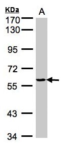 YARS / Tyrosyl-tRNA Synthetase Antibody - Sample(30 ug whole cell lysate). A: H1299. 7.5% SDS PAGE. YARS antibody diluted at 1:1000.