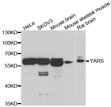 YARS / Tyrosyl-tRNA Synthetase Antibody - Western blot analysis of extracts of various cell lines.