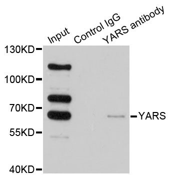 YARS / Tyrosyl-tRNA Synthetase Antibody - Immunoprecipitation analysis of 200ug extracts of HeLa cells.