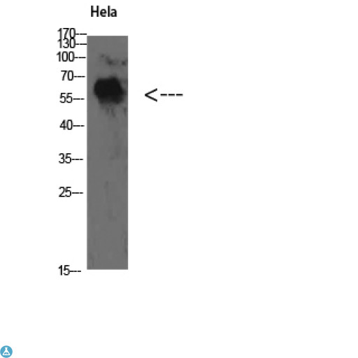 YARS / Tyrosyl-tRNA Synthetase Antibody - Western Blot (WB) analysis of HeLa cells using TyrRS Polyclonal Antibody diluted at 1:500.