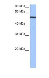 YARS / Tyrosyl-tRNA Synthetase Antibody - Jurkat cell lysate. Antibody concentration: 0.5 ug/ml. Gel concentration: 12%.  This image was taken for the unconjugated form of this product. Other forms have not been tested.