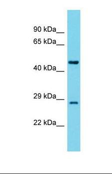 YARS2 Antibody - Western blot of Rat Lung. Yars2 antibody dilution 1.0 ug/ml.  This image was taken for the unconjugated form of this product. Other forms have not been tested.