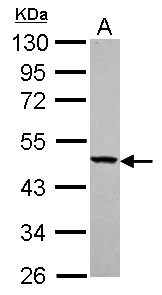YARS2 Antibody - Sample (30 ug of whole cell lysate) A: NT2D1 10% SDS PAGE YARS2 antibody diluted at 1:1000