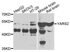 YARS2 Antibody - Western blot analysis of extracts of various cells.