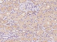 YARS2 Antibody - Immunochemical staining of human YARS2 in human kidney with rabbit polyclonal antibody at 1:100 dilution, formalin-fixed paraffin embedded sections.