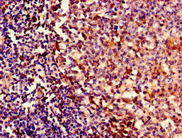 YBEY / C21orf57 Antibody - Immunocytochemistry analysis of human tonsil tissue diluted at 1:100