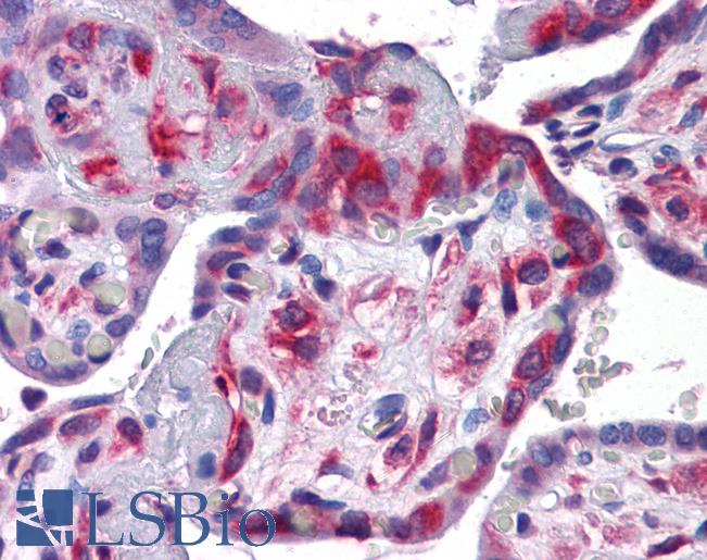 YBX1 / YB1 Antibody - Anti-YBX1 / YB1 antibody IHC of human placenta. Immunohistochemistry of formalin-fixed, paraffin-embedded tissue after heat-induced antigen retrieval. Antibody concentration 5 ug/ml.  This image was taken for the unconjugated form of this product. Other forms have not been tested.