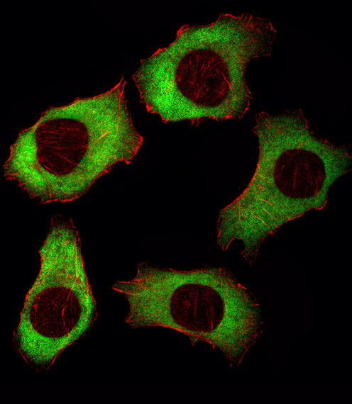 YBX1 / YB1 Antibody - Fluorescent image of A549 cell stained with YBX1 Antibody. A549 cells were fixed with 4% PFA (20 min), permeabilized with Triton X-100 (0.1%, 10 min), then incubated with YBX1 primary antibody (1:25, 1 h at 37°C). For secondary antibody, Alexa Fluor 488 conjugated donkey anti-rabbit antibody (green) was used (1:400, 50 min at 37°C). Cytoplasmic actin was counterstained with Alexa Fluor 555 (red) conjugated Phalloidin (7units/ml, 1 h at 37°C). YBX1 immunoreactivity is localized to Cytoplasm significantly.