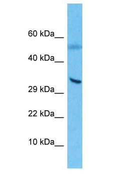 YBX1 / YB1 Antibody - YBX1 / YB1 antibody Western Blot of Thymus Tumor. Antibody dilution: 1 ug/ml.  This image was taken for the unconjugated form of this product. Other forms have not been tested.