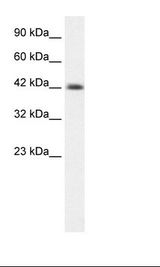 YBX1 / YB1 Antibody - Jurkat Cell Lysate.  This image was taken for the unconjugated form of this product. Other forms have not been tested.
