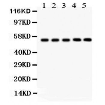 YBX1 / YB1 Antibody - YB1 antibody Western blot. All lanes: Anti YB1 at 0.5 ug/ml. Lane 1: Rat Liver Tissue Lysate at 50 ug. Lane 2: Mouse Liver Tissue Lysate at 50 ug. Lane 3: SMMC Whole Cell Lysate at 40 ug. Lane 4: RH35 Whole Cell Lysate at 40 ug. Lane 5: HEPG2 Whole Cell Lysate at 40 ug. Predicted band size: 36 kD. Observed band size: 50 kD.