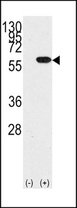 YBX1 / YB1 Antibody - Western blot of YBX1 (arrow) using rabbit polyclonal YBX1 Antibody (RB14116). 293 cell lysates (2 ug/lane) either nontransfected (Lane 1) or transiently transfected with the YBX1 gene (Lane 2) (Origene Technologies).