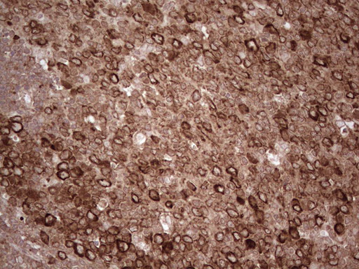 YBX1 / YB1 Antibody - Immunohistochemical staining of paraffin-embedded Human tonsil within the normal limits using anti-YBX1 mouse monoclonal antibody. (Heat-induced epitope retrieval by 1 mM EDTA in 10mM Tris, pH8.5, 120C for 3min,