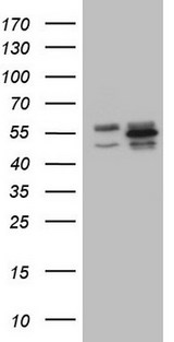 YBX1 / YB1 Antibody - HEK293T cells were transfected with the pCMV6-ENTRY control (Left lane) or pCMV6-ENTRY YBX1 (Right lane) cDNA for 48 hrs and lysed. Equivalent amounts of cell lysates (5 ug per lane) were separated by SDS-PAGE and immunoblotted with anti-YBX1.