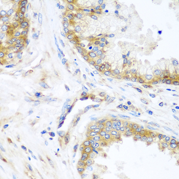 YBX1 / YB1 Antibody - Immunohistochemistry of paraffin-embedded human prostate.