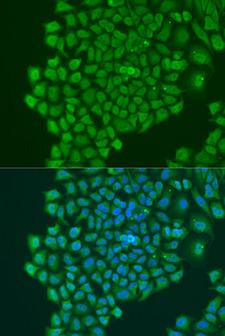 YBX1 / YB1 Antibody - Immunofluorescence analysis of U2OS cells using YBX1 Polyclonal Antibody at dilution of 1:100.Blue: DAPI for nuclear staining.