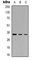 YBX1 / YB1 Antibody - Western blot analysis of YBX1 (pS102) expression in HeLa (A); MCF7 (B); Jurkat (C) whole cell lysates.