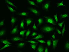 YBX1 / YB1 Antibody - Immunofluorescence staining of YBX1 in HeLa cells. Cells were fixed with 4% PFA, permeabilzed with 0.1% Triton X-100 in PBS, blocked with 10% serum, and incubated with rabbit anti-Human YBX1 polyclonal antibody (dilution ratio 1:200) at 4°C overnight. Then cells were stained with the Alexa Fluor 488-conjugated Goat Anti-rabbit IgG secondary antibody (green). Positive staining was localized to Nucleus and Cytoplasm.