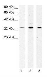 YBX3 / CSDA Antibody - 1. Jurkat Cell Lysate, 2. HepG2 Cell Lysate, 3. Fetal Muscle Lysate.  This image was taken for the unconjugated form of this product. Other forms have not been tested.