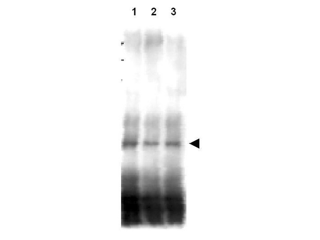 Yeast Mer2 Antibody - Anti-Mer2 pS30 Antibody - Western Blot. Western blot of affinity purified anti-S. cerevisiae Mer2 antibody shows detection of phosphorylated and unphosphorylated Mer2 in wild type, phosphatase treated and mutant cells. Lane 1 contains Mer2-myc protein detected in wild type cells after first immunoprecipitating the protein using anti-myc antibody. Cells were harvested 4 h after the initiation of meiosis and therefore contain mostly phosphorylated Mer2. Lane 2 contains the same preparation after treatment with phosphatase. Lane 3 contains Mer2-S30A protein as a phosphorylation control. This antibody is reactive with both phosphor-ylated and unphosphorylated Mer2 at the S30 position. The primary antibody was used at a 1:5000 dilution. Personal Communication. Michael Lichten, NIH, CCR, Bethesda, MD.