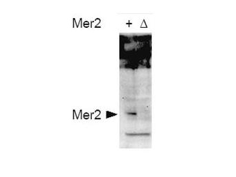 Yeast Mer2 Antibody - Anti-Mer2 pS30 Antibody - Western Blot. Western blot of affinity purified anti-S. cerevisiae Mer2 pS30 antibody shows detection of phosphorylated Mer2 in whole cell extracts. Cells were either wild type (+) or contained mer2 deletions (D). Extracts were prepared from cells 4hr after initiation of meiosis. Proteins were obtained using TCA precipitation. The primary antibody was used at a 1:7500 dilution. Secondary antibody was used at 1:5000 dilution. Personal Communication. Michael Lichten, NIH, CCR, Bethesda, MD.