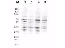 Yeast Rfa2 Antibody - Anti-RFA2 Antibody - Western Blot. This product was assayed by western blotting against RFA2 containing cell lysates. Blot incubated for 1 hr at RT with affinity purified Rabbit anti-RFA2 pan reactive Lot 13229 at 1.0 ug/ml followed by 1:5000 dilution of IRDye800 Sheep anti-Rabbit IgG for 1 hr at RT.