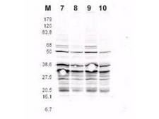 Yeast Rfa2 Antibody - Anti-RFA2 pS122 Antibody - Western Blot. This product was assayed by western blotting against RFA2 containing cell lysates. Affinity purified rabbit anti-RFA2 pS122 specific Lot 13230 at 1.0 ug/ml for 1 hr at RT followed by IRDye 800 Sh anti-Rabbit IgG 1:5000 1 hr RT.