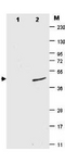 Yeast SUMO Antibody - Anti-ySUMO Antibody - Western Blot. Western blot of ySUMO fusion protein. Anti-ySUMO antibody, generated by immunization with recombinant yeast SUMO, was tested by western blot against a SUMO-GFP fusion protein (lane 2). While the actual molecular weight of the fusion protein is 39 kD, the protein migrates as a 49 kD band (arrowhead). No reactivity is seen for lane 1 which contains His-tagged GFP protein. The membrane was blocked using BLOTTO. Primary antibody was used at a 1:1000 dilution in BLOTTO. The membrane was washed and reacted with a 1:10000 dilution of IRDye 800 Conjugated Affinity Purified Goat-anti-Mouset IgG (H&L) MX10 (800 nm channel). Molecular weight estimation was made by comparison to prestained MW markers indicated at the right (lane M, 700 nm channel). Other detection systems will yield similar results.