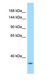 YEATS2 Antibody - YEATS2 antibody Western Blot of Mouse Lung.  This image was taken for the unconjugated form of this product. Other forms have not been tested.