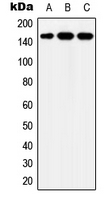 YEATS2 Antibody - Western blot analysis of YEATS2 expression in MCF7 (A); SP2/0 (B); HeLa (C) whole cell lysates.