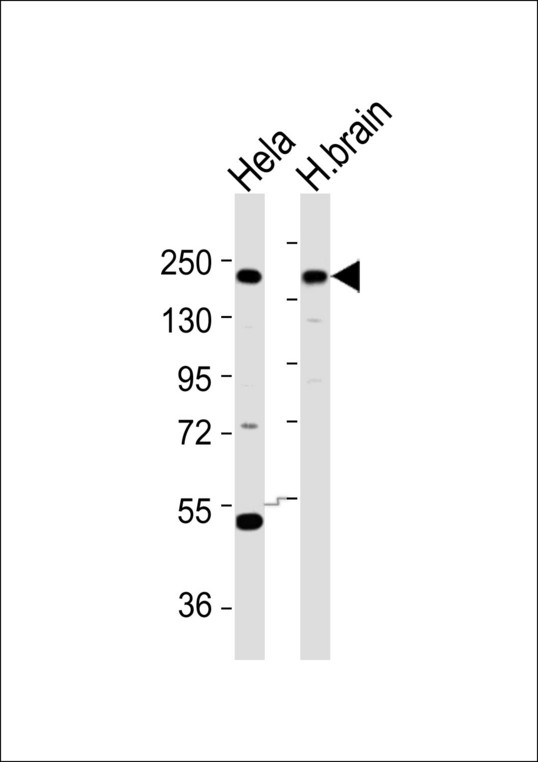YEATS2 Antibody - All lanes : Anti-YEATS2 Antibody at 1:1000 dilution Lane 1: HeLa whole cell lysates Lane 2: H.brain tissue lysates Lysates/proteins at 20 ug per lane. Secondary Goat Anti-Rabbit IgG, (H+L),Peroxidase conjugated at 1/10000 dilution Predicted band size : 151 kDa Blocking/Dilution buffer: 5% NFDM/TBST.
