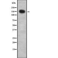 YEATS2 Antibody - Western blot analysis of YEATS2 using 293 whole cells lysates