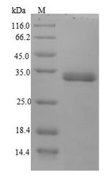 ail Protein - (Tris-Glycine gel) Discontinuous SDS-PAGE (reduced) with 5% enrichment gel and 15% separation gel.