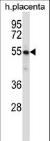 YES1 / c-Yes Antibody - Mouse Yes1 Antibody western blot of human placenta tissue lysates (35 ug/lane). The Yes1 antibody detected the Yes1 protein (arrow).