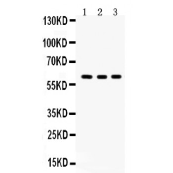 YES1 / c-Yes Antibody - YES1 antibody Western blot. All lanes: Anti YES1 at 0.5 ug/ml. Lane 1: SGC Whole Cell Lysate at 40 ug. Lane 2: A549 Whole Cell Lysate at 40 ug. Lane 3: HEPG2 Whole Cell Lysate at 40 ug. Predicted band size: 61 kD. Observed band size: 61 kD.