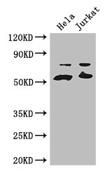 YES1 / c-Yes Antibody - Positive WB detected in:Hela whole cell lysate,Jurkat whole cell lysate;All lanes: YES1 antibody at 3.2ug/ml;Secondary;Goat polyclonal to rabbit IgG at 1/50000 dilution;Predicted band size: 61 kDa;Observed band size: 61,70 kDa;