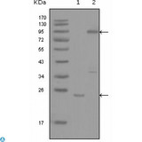 YES1 / c-Yes Antibody - Western Blot (WB) analysis using c-Yes Monoclonal Antibody against truncated YES1-His recombinant protein (1) and full-length GFP-YES1(aa1-543) transfected COS7 cell lysate (2).