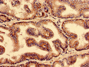 YIF1B Antibody - Immunohistochemistry analysis of human prostate tissue using YIF1B Antibody at dilution of 1:100