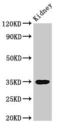 YIF1B Antibody - Western Blot Positive WB detected in: Rat kidney tissue All lanes: YIF1B antibody at 3µg/ml Secondary Goat polyclonal to rabbit IgG at 1/50000 dilution Predicted band size: 35, 32, 34, 33 kDa Observed band size: 35 kDa