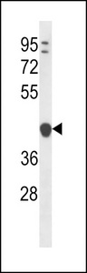 YIPF1 Antibody - YIPF1 Antibody western blot of ZR-75-1 cell line lysates (35 ug/lane). The YIPF1 antibody detected the YIPF1 protein (arrow).