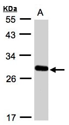 YIPF4 Antibody - Sample (30 ug whole cell lysate). A: A431. 12% SDS PAGE. YIPF4 antibody diluted at 1:1000
