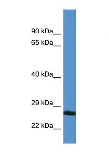 YIPF4 Antibody - YIPF4 antibody Western blot of COL0205 Cell lysate. Antibody concentration 1 ug/ml.  This image was taken for the unconjugated form of this product. Other forms have not been tested.